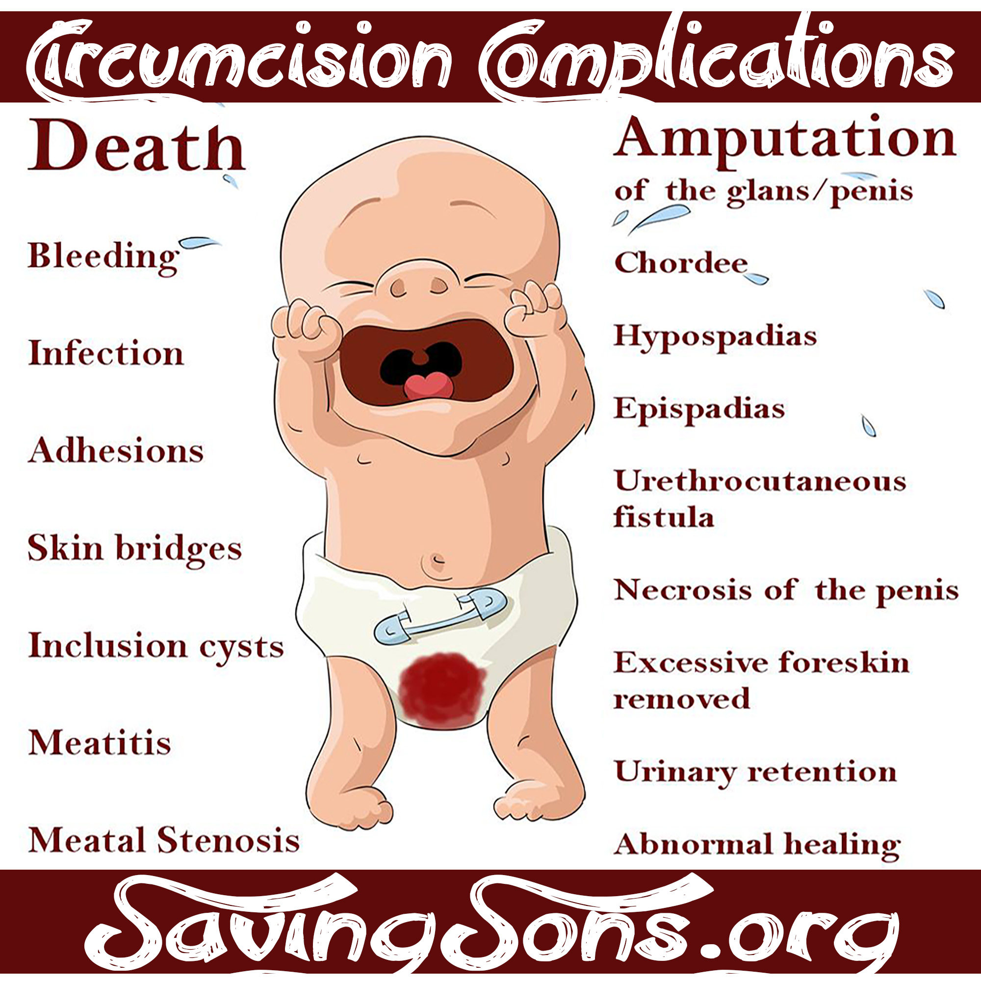 Circumcision Complications Stickers