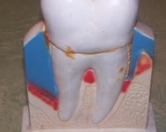 Vintage Chalk ware advertising tooth display Procter & Gamble periodontal disease gingivitis Crest Professional Services