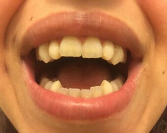Day-Wolf Fangs (Custom made from scratch)