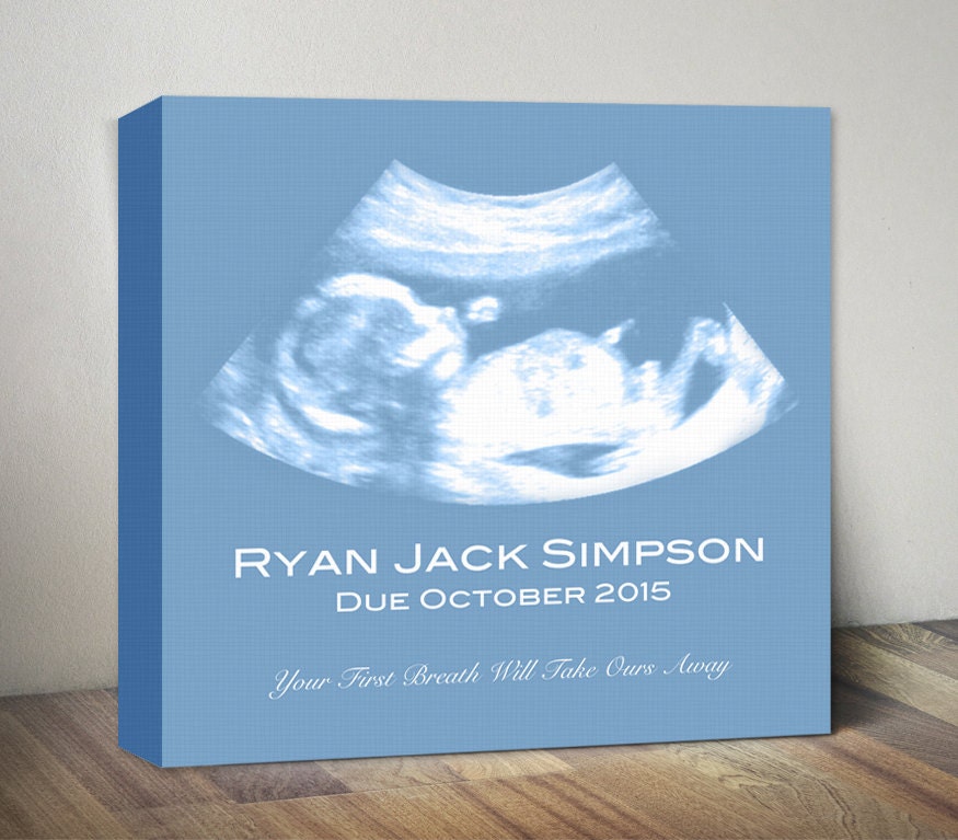 Ultrasound Canvas Sonogram Art Print Baby Shower Gift