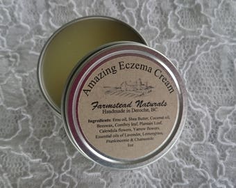 Amazing Eczema Cream, Eczema, Eczema Salve, Eczema Lotion, Psoriasis, Salve, Handmade, Natural, Natural Skincare,Homemade,Lotion,Body Lotion