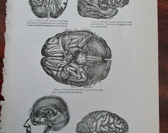 original page - 1916 MEDICAL CHART from antique medical book - brain