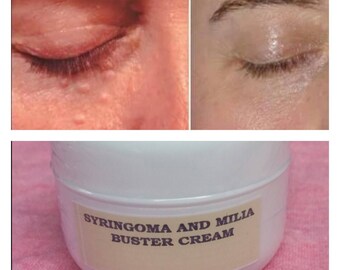 syringoma and milia buster cream
