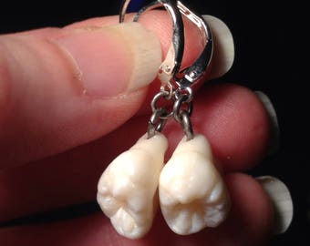 YOUR SUPPLIED TEETH Made Into Sterling Silver Leverback Earrings