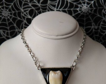 Real Human Tooth Pendant, 095 *Minor Flaw, Please See Pictures and Description*