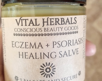 Eczema & Psoriasis salve, organic eczema treatment, dermatitis salve, dermatitis treatment, organic psoriasis treatment, natural eczema