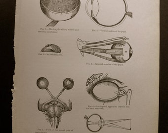 1916 MEDICAL CHART from antique medical book - eye
