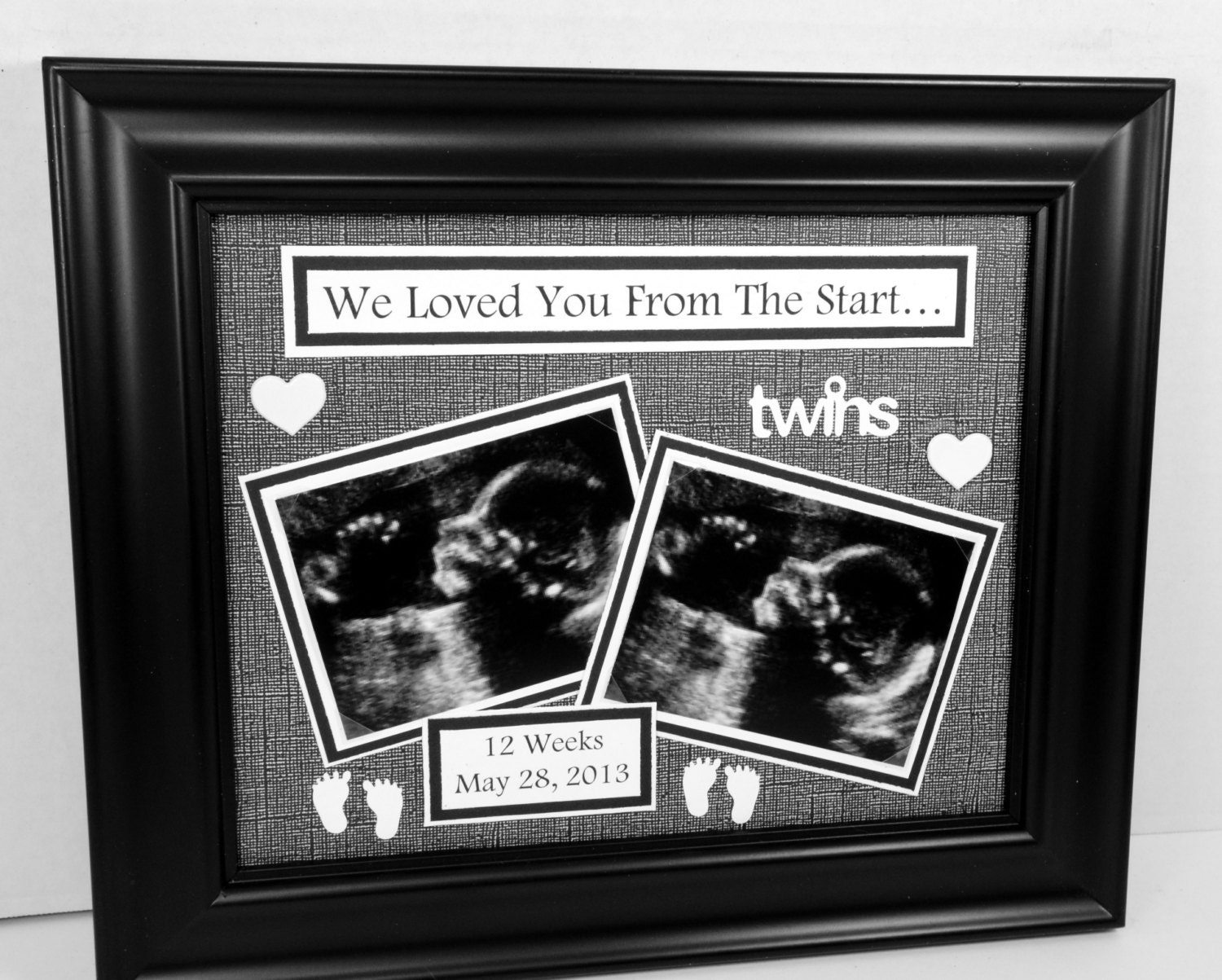 Twins Ultrasound Sonogram Frame I We Loved You From The Zoom