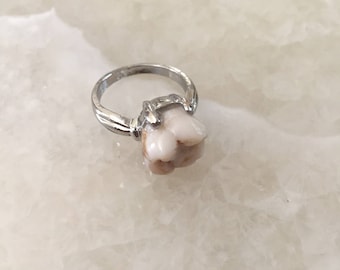 Genuine Human Molar Ring