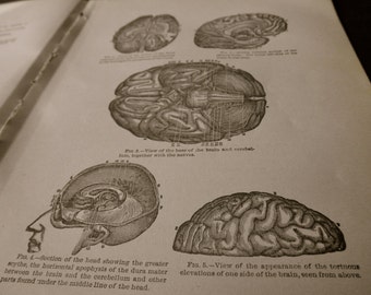 1916 MEDICAL CHART from antique medical book - brain