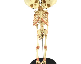 Siamese Twin Conjoined Baby Fetus Plastic Skeleton