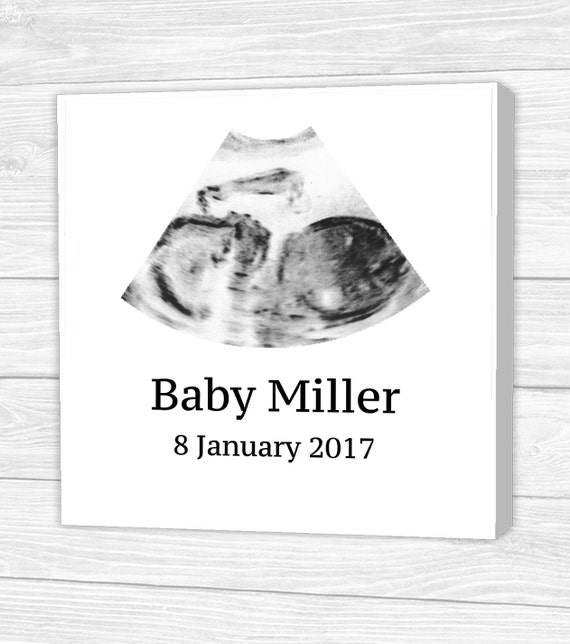 Personalised Baby Scan Photo Canvas Using Your Own Ultrasound