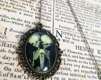 Conjoined twins pendant necklace