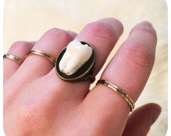 YOUR SUPPLIED TOOTH Made Into Antique Brass Size 6 Ring