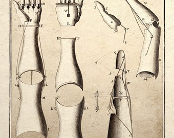 Steampunk Art Print Mechanical Arm Medical Patent Design