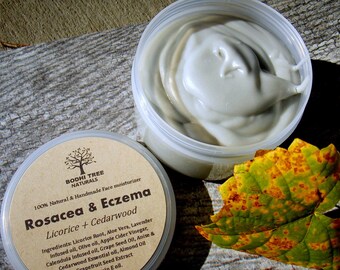 4oz Eczema/Rosacea/Dermatitis Balm - Rosacea cream - Eczema Cream - Eczema balm - Skin Irritation balm - Redness relief - Handmade SkinCare/