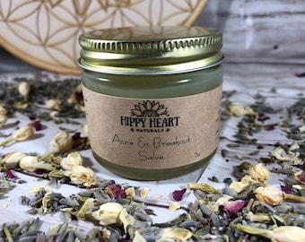 Acne prone Moisturizer/ breakout Salve / acne treatment / rosacea / vegan / dark marks/ fade acne scars/ oily skin / daily moisturizer