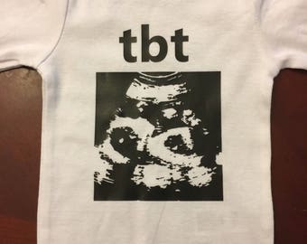 Tbt Ultrasound onesie