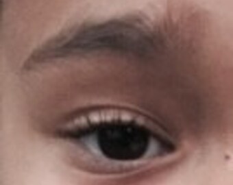 Solutions For Eyebrow Loss for Children