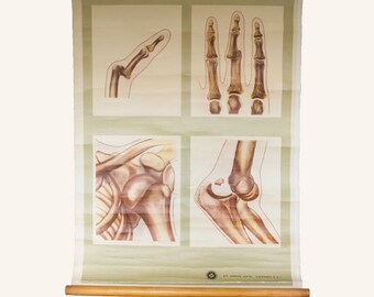 Vintage St Johns Dislocations Wall Chart