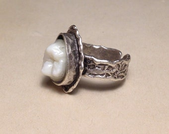 Tooth Fairy Series: Real Human Single Molar Teardrop Setting Adjustable Silver Ring