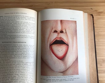 Antique medical book illustrated Diseases of the Genito Urinary organs color plates illustrations man woman anatomy