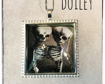 Conjoined twins skeleton