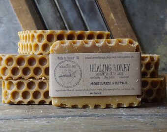 Healing Honey Soap | Moisturizing Soap, Acne Soap, Eczema Soap, Face Soap, Homemade Soap, Gentle, Unscented, Homemade Soap