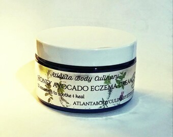 8 oz Avocado honey eczema cream organic eczema cream vegan eczema cream eczema organic eczema cure
