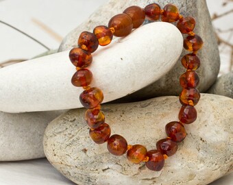 Baltic Amber Teething Anklet UK Handmade