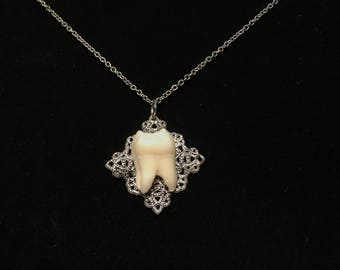 Genuine Human Molar Necklace