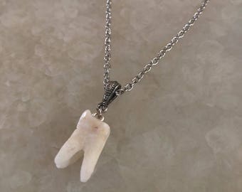 Human Molar Pendant Necklace