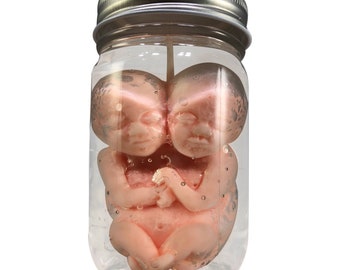 Specimen Siamese Twin Fetus Candle