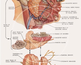 Plate 1: Parotidectomy - 10x14 Giclée Canvas Print of Vintage Surgical Illustration