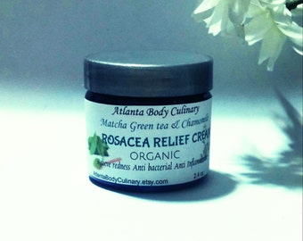 Rosacea Relief cream organic rosacea balm vegan rosacea cream redness relief face cream