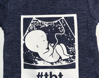 Baby Outfit - TBT