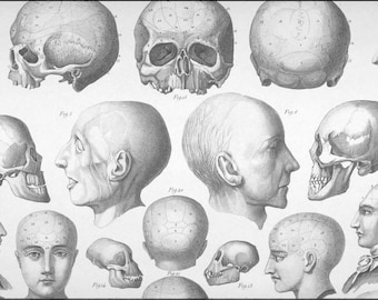 Anatomical art, Skull bone, Human skull print, Vintage anatomy, #201