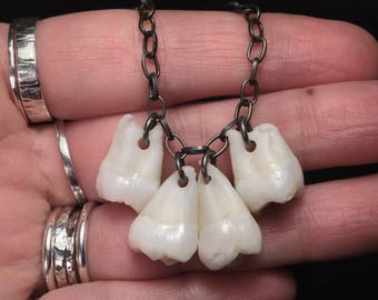 YOUR SUPPLIED TEETH - Real Human Molar Necklace with Your Supplied Teeth