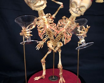 SALE Conjoined Twins Siamese Fetal Skeletons