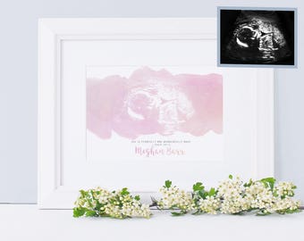 Miscarriage Gift - Miscarriage memorial Keepsake - Watercolour Ultrasound Art - Baby Angel Memorial - Baby Loss Gift - Miscarriage Memory