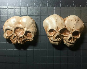 Conjoined Twin Skulls Fetal and Adult Magnets