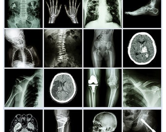 X-rays - Ceramic Waterslide Decal - Enamel Decal - Fusible Decal - 493648