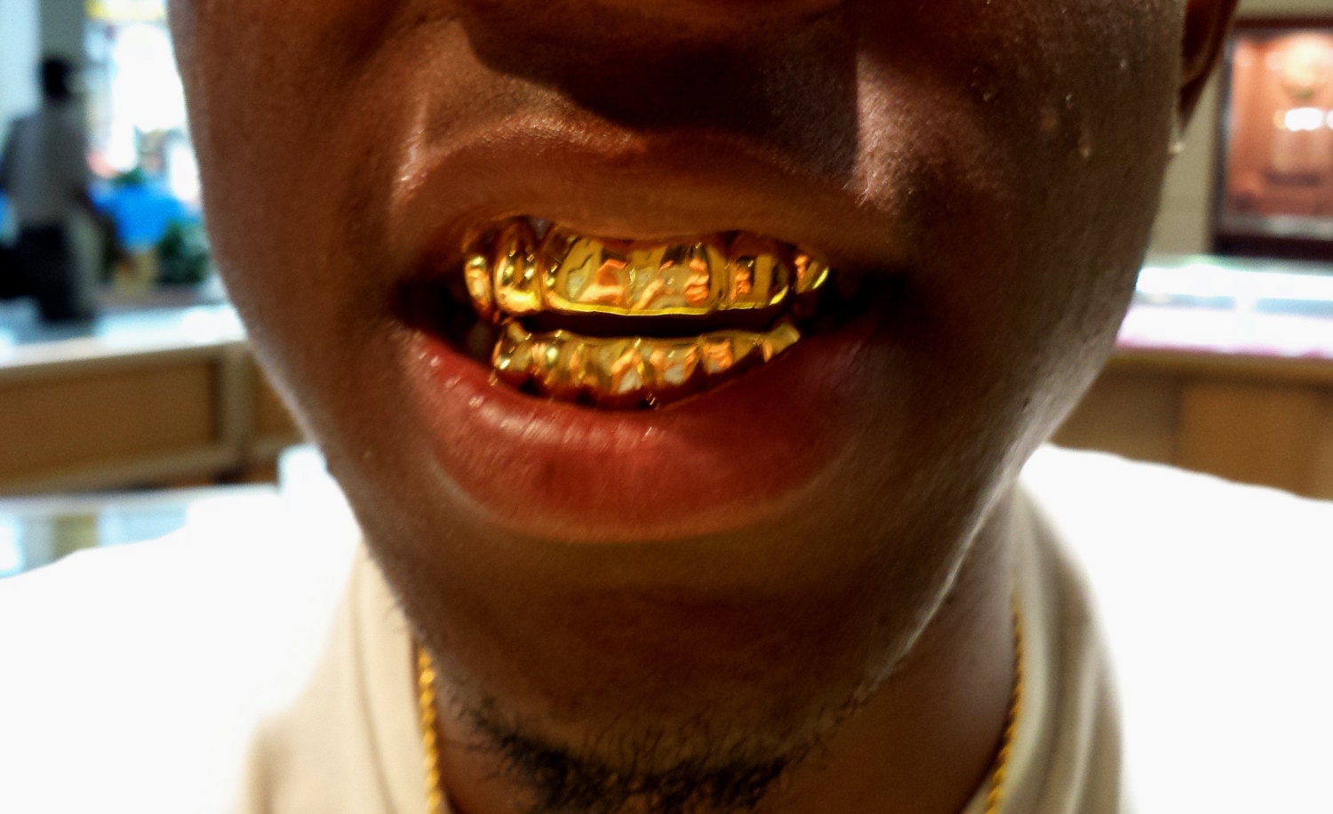 18K Solid Yellow Gold Custom Fit REAL Gold Grill Grillz Gold Teeth 18K Solid Yellow Gold Custom Fit REAL Gold Grill Grillz Gold Teeth